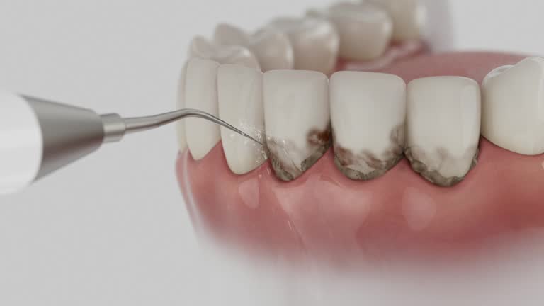 Reliable Tooth Extraction contractor in Morgan County County, TN by Dentist Open Now